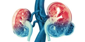 acute kidney injury sepsis AM-Pharma