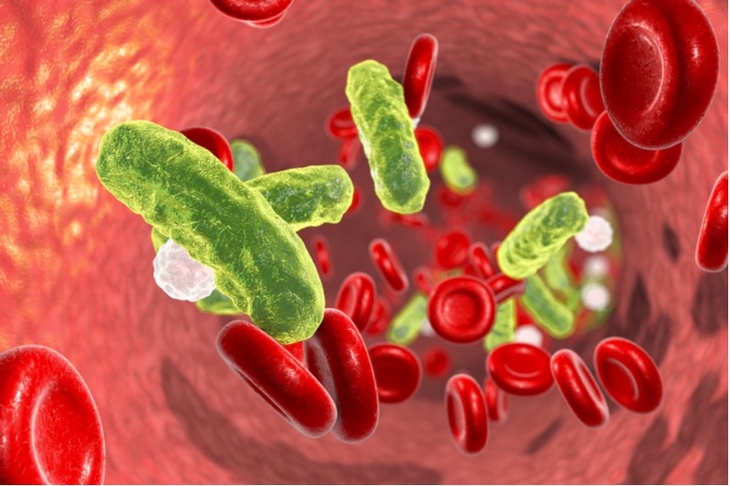 acute kidney injury sepsis AM-Pharma blood