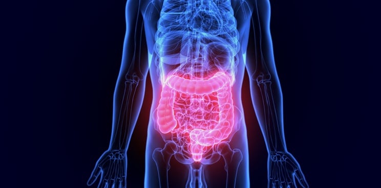 inflammatory bowel disease treatment personalized medicine predictimmune