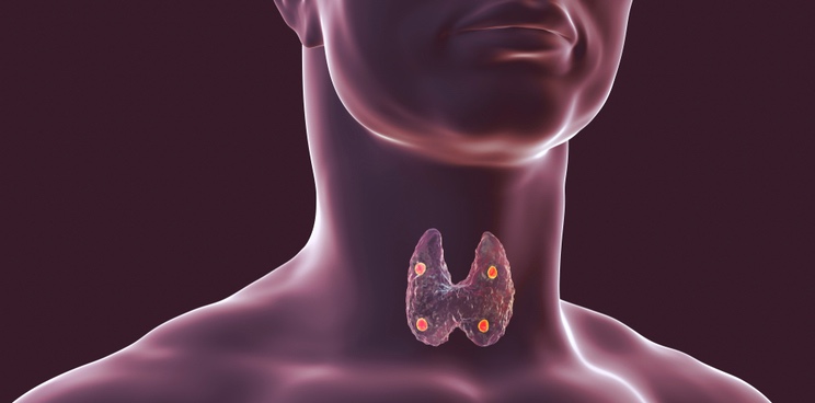 hypoparathyroidism