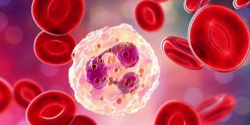 chemocentryx vifor fresenius medical care renal pharma anca vasculitis