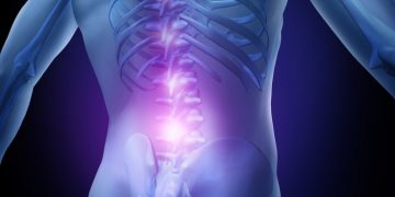 grunenthal mesoblast chronic low back pain