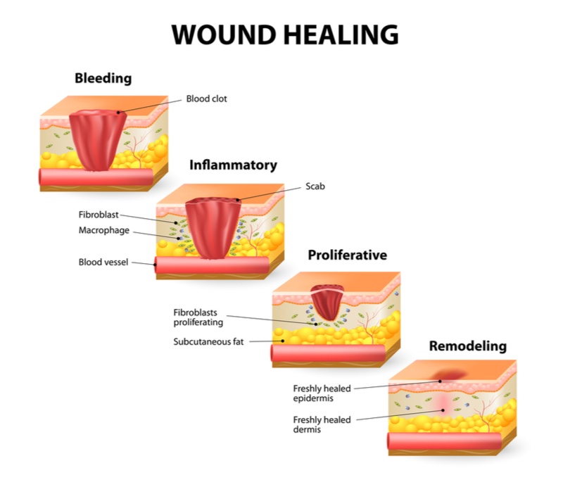 wound healing tooth loss omnio sweden