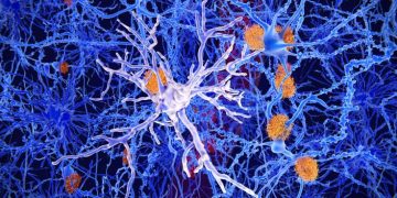 alzheimer's disease treatment vivoryon therapeutics