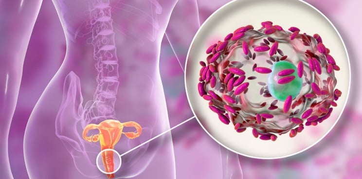 bacterial vaginosis treatment