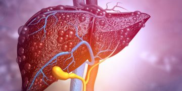 nash northsea therapeutics