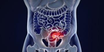 colorectal cancer car-t celyad