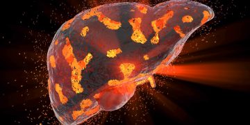 liver diseases, liver, liver disease treatment