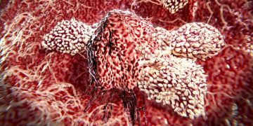 cancer immunotherapy immunos therapeutics