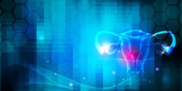 uterine fibroids obseva