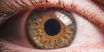 cornea transplant tej kohli india uk