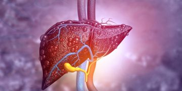 nash northsea therapeutics