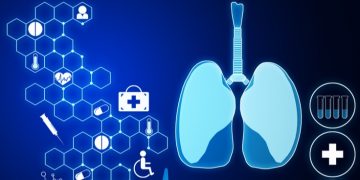 lung ai exscientia coronavirus
