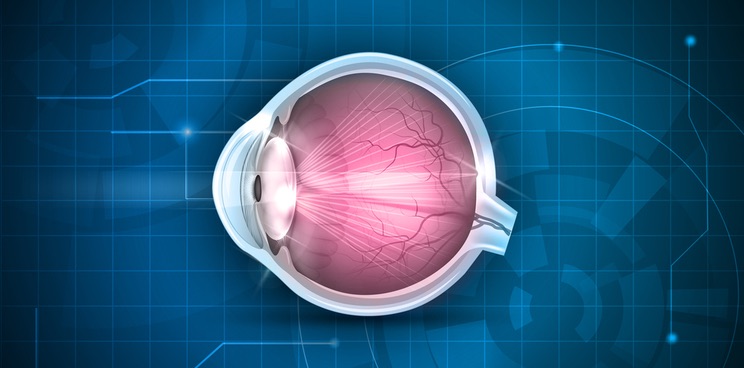 cataract surgery recovery oculis