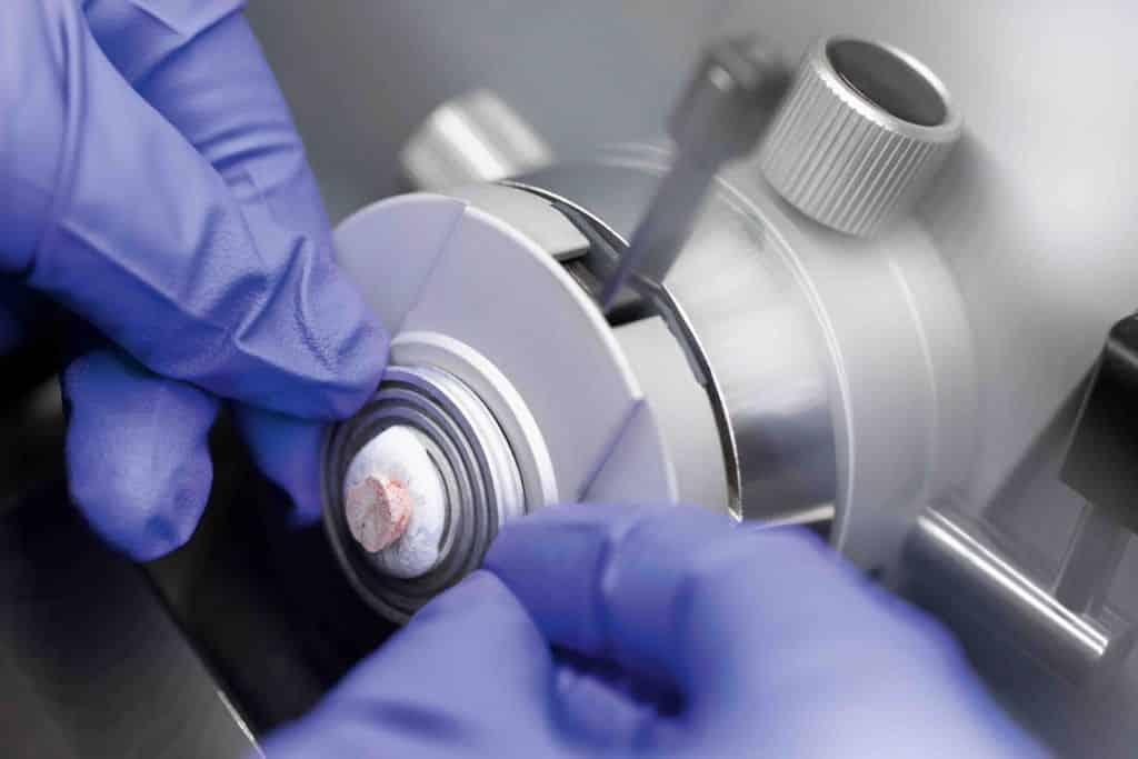 Indivumed, biospecimen, spatial transcriptomics, cancer