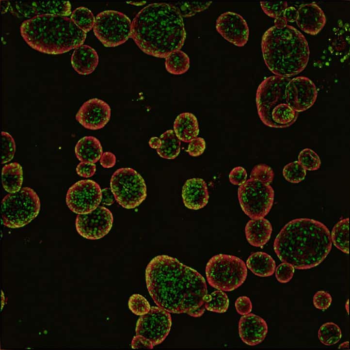 organoids in a dish, drug development, patient relevant model