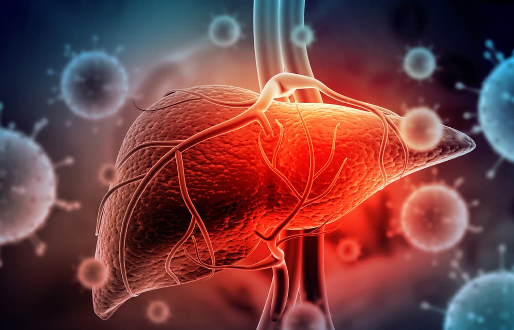 HDV hepatitis liver