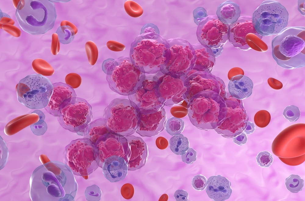 leukaemia leukemia