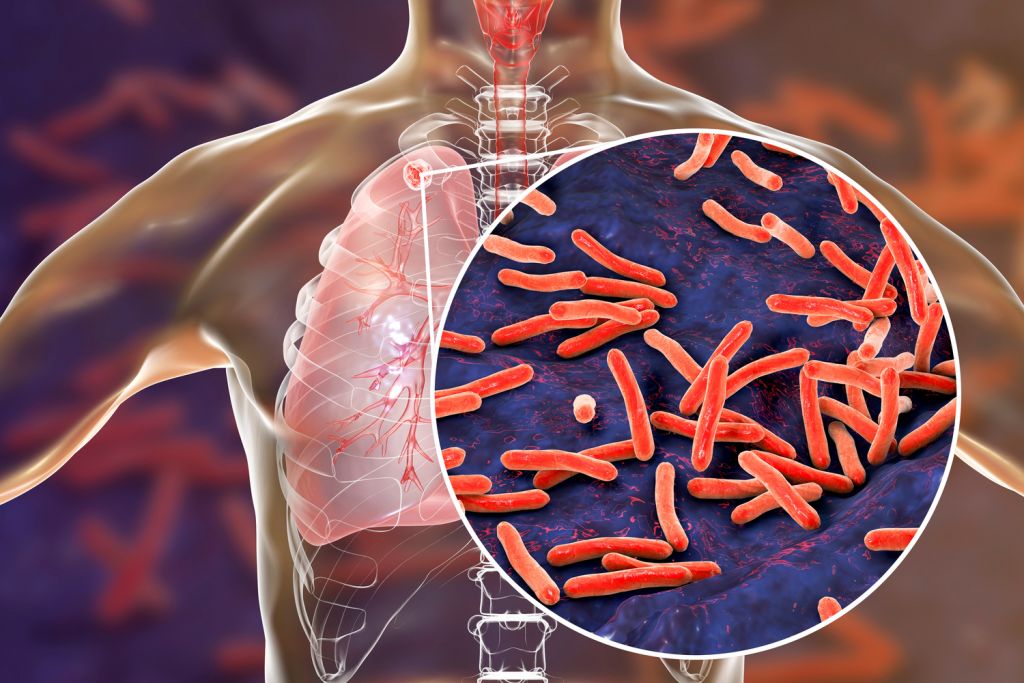 PAN-TB collaboration: a new project for tuberculosis treatment