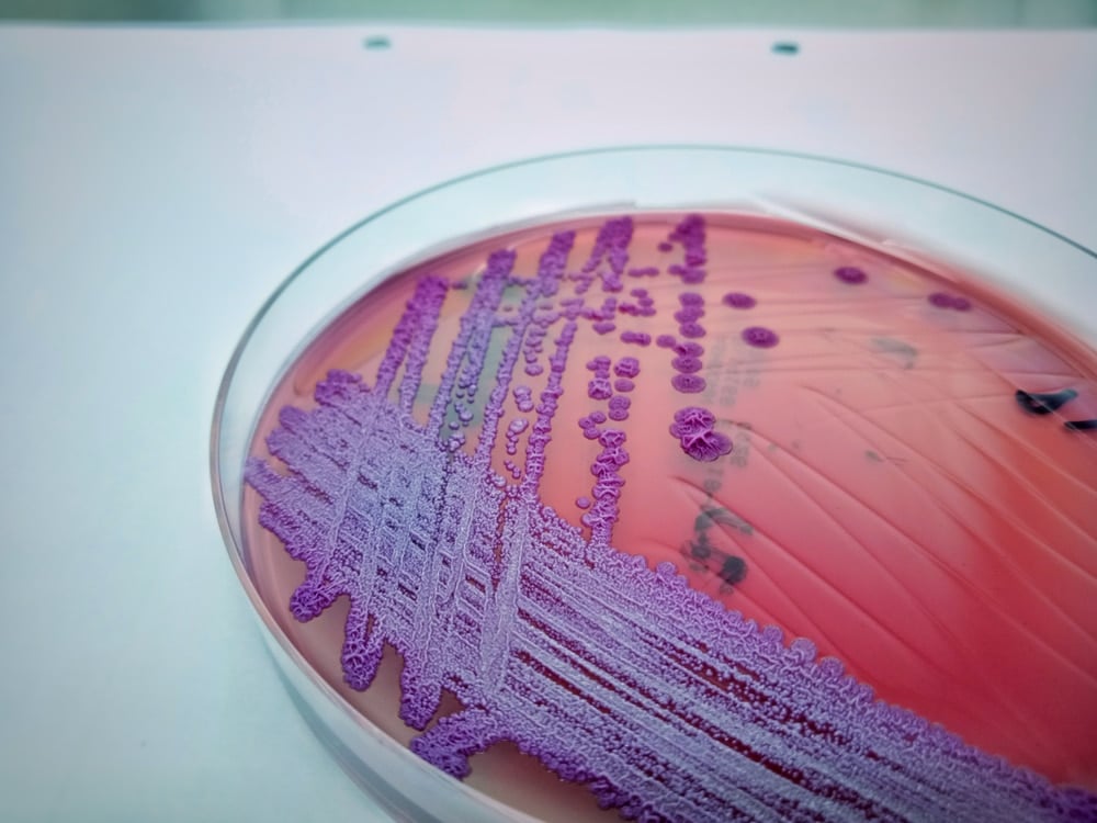 Melioidosis Burkholderia pseudomallei