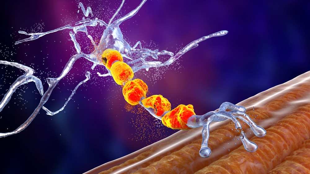 motor neuron neurone disease MND