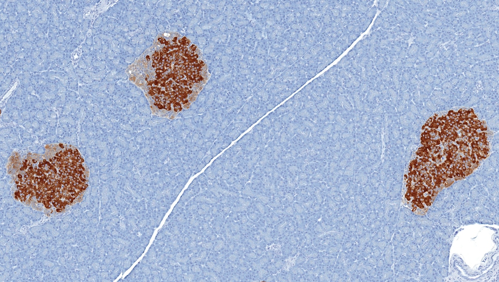 islets of Langerhans pancreas diabetes