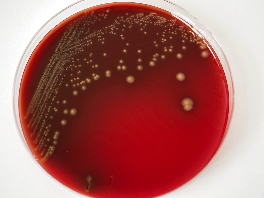 streptococcus B