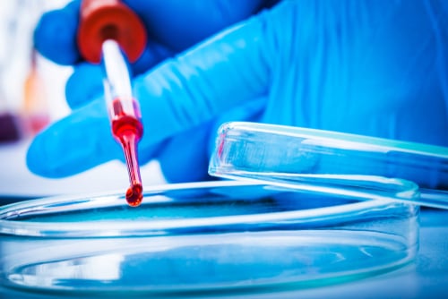 liquid biopsy