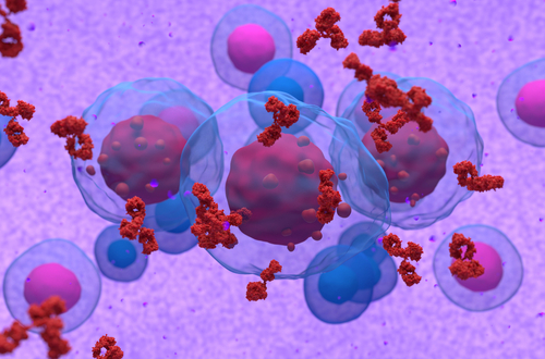 multiple myeloma