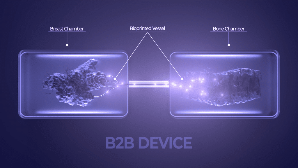 organ-on-a-chip, breast cancer, metastasis