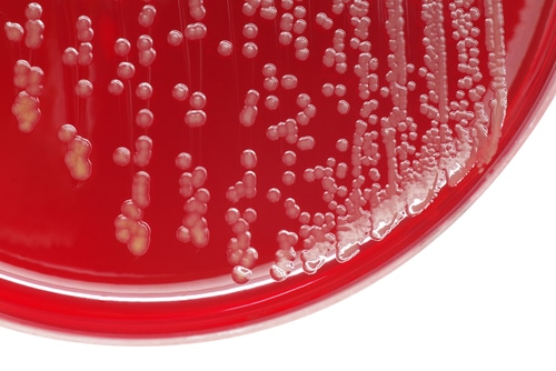 Staphylococcus aureus MRSA TSS