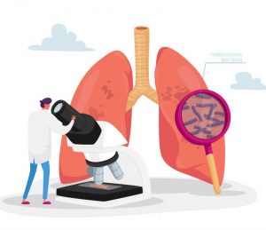 Tuberculosis research