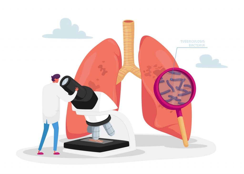 Tuberculosis research