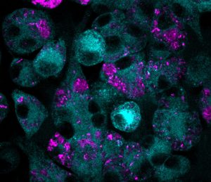 macrophages treated with MTX