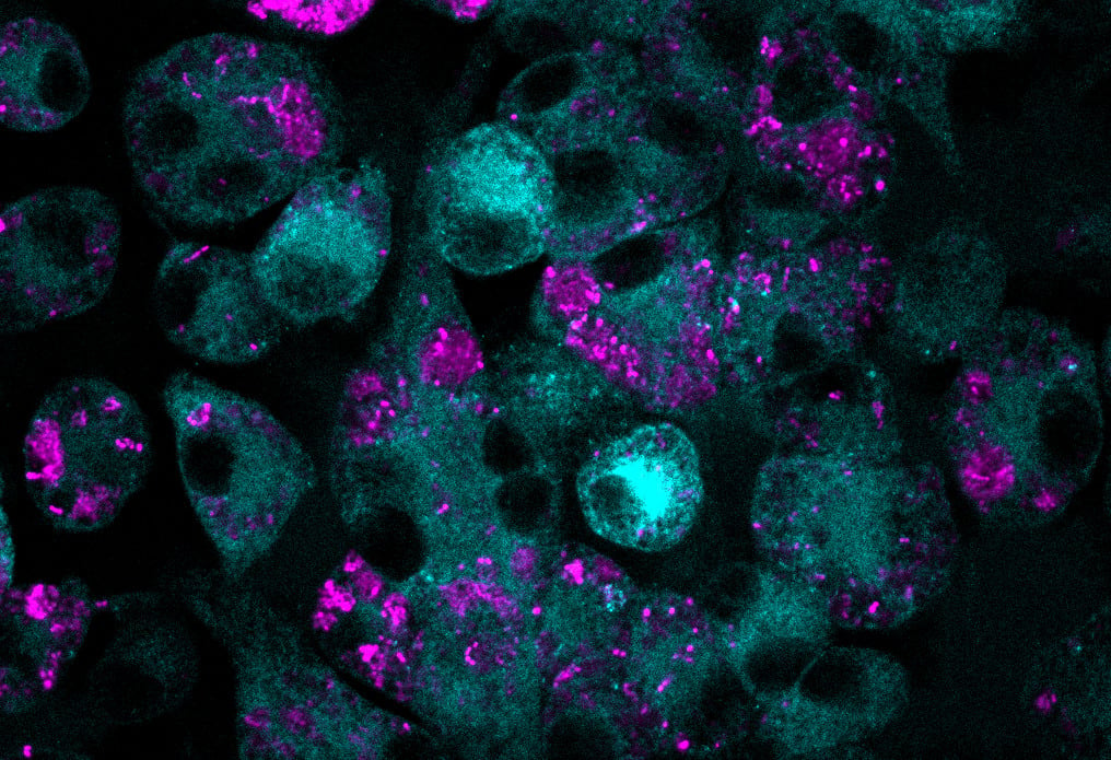 macrophages treated with MTX