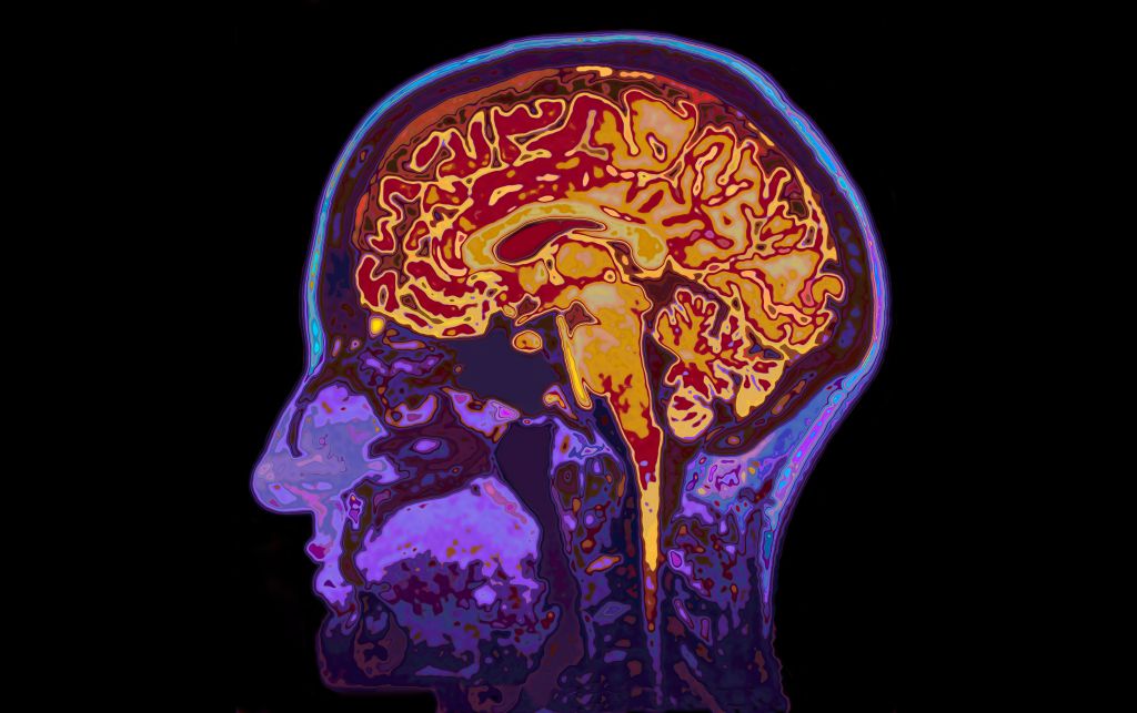 Glioblastoma clinical trials