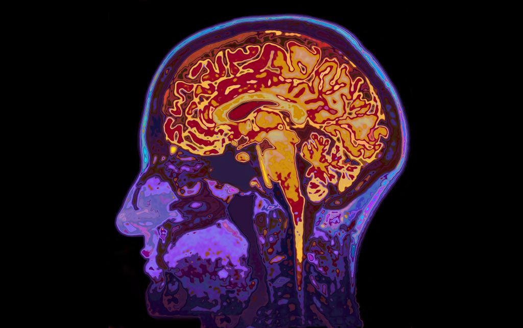 Glioblastoma clinical trials