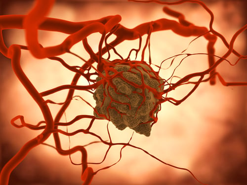 cancer tumor blood vessels