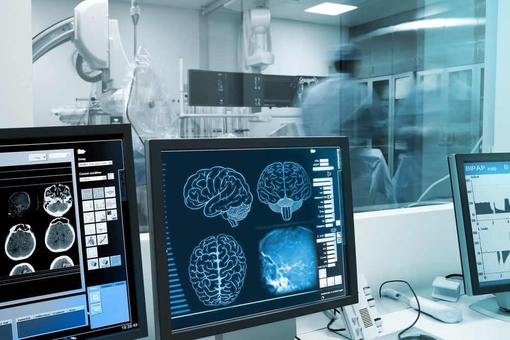 Parkinson's disease research biomarker