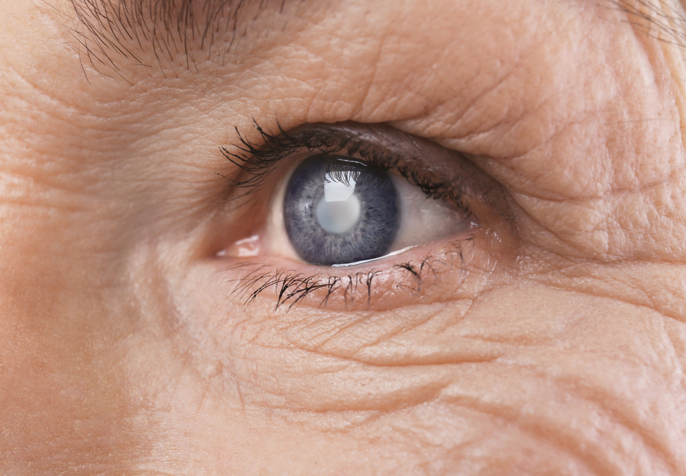 eye disease geographic atrophy