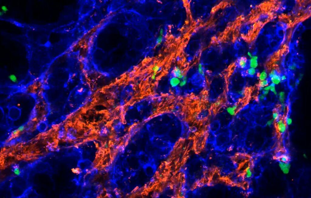 Fluorescence microcopy image of gamma delta T cells (green) attacking cancer cells (blue). To get tot he cancer cells, the immune cells need to navigate through a dense extracellular matrix that surrounds the tumor tissue (red). Image: Katrin Raute / University of Freiburg