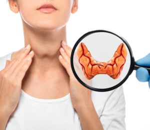 underachieve thyroid hypothyroidism