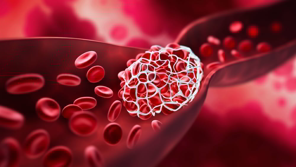 blood clotting