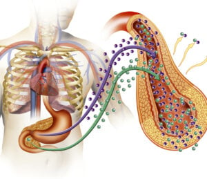 type 1 diabetes