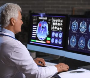 X-linked cerebral adrenoleukodystrophy