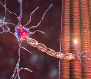 Duchenne muscular dystrophy