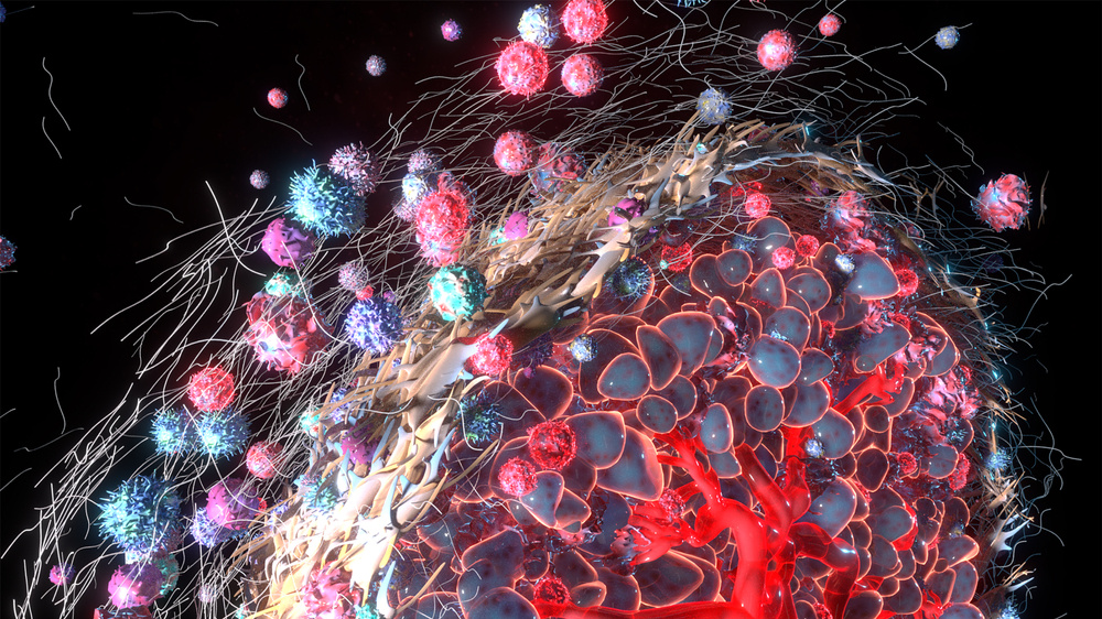 tumor microenvironment