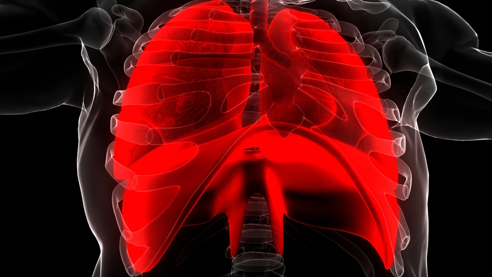 pulmonary sarcoidosis