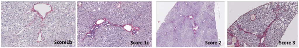 Preclinical model: link between chronic inflammation and cancer