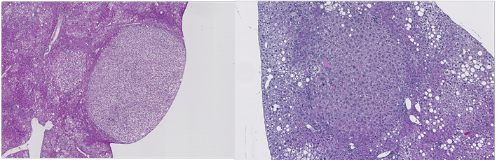 Preclinical models: link between chronic inflammation and cancer